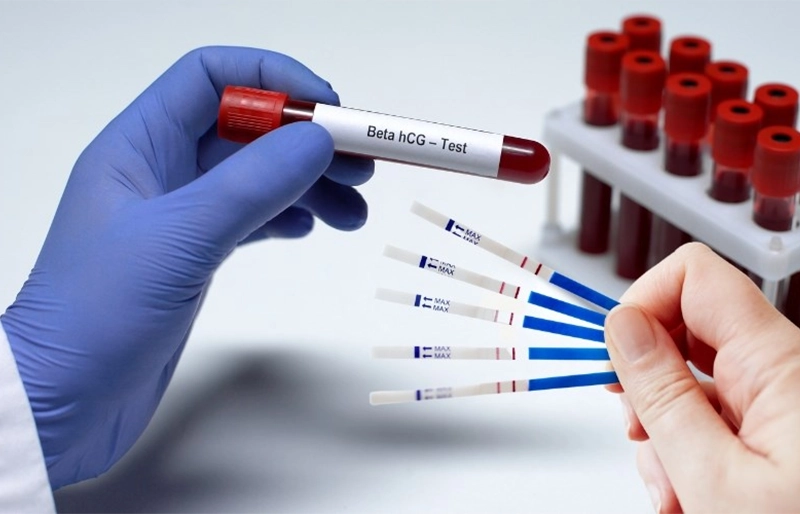 xét nghiệm máu (beta-hCG)