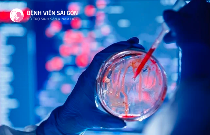 Xét nghiệm sinh hóa máu gồm nhiều xét nghiệm khác nhau, mục đích là để đo lường các chất trong máu. 