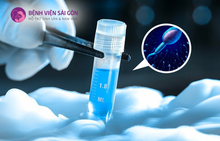 Trữ đông tinh trùng đóng vai trò quan trọng trong bảo vệ sinh sản ở nam giới