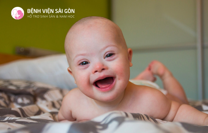 Tuổi của mẹ càng cao nguy cơ sinh con mắc hội chứng Down càng lớn