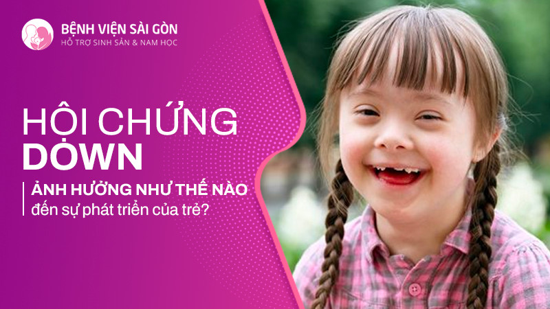 Hội chứng Down ảnh hưởng thế nào tới sự phát triển của trẻ