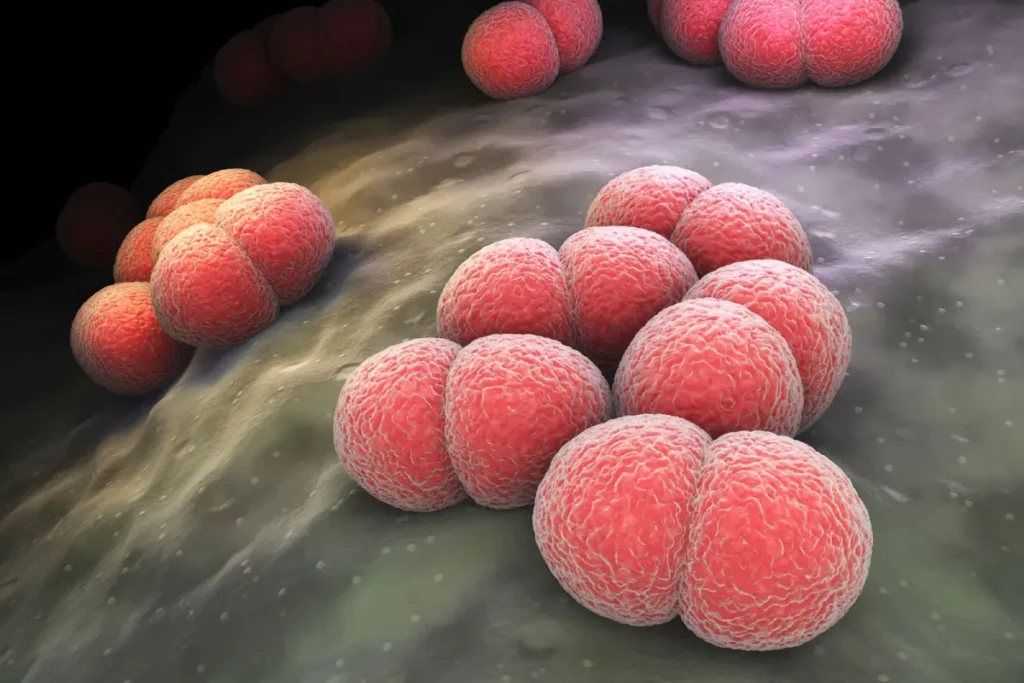 Bệnh não mô cầu do vi khuẩn Neisseria meningitidis gây ra